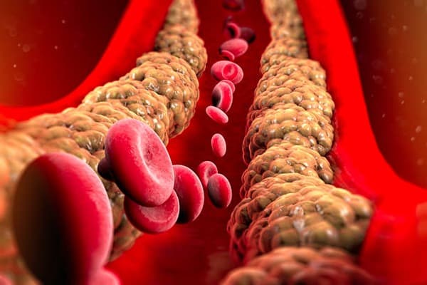 Body fluids and circulation Quiz 1
