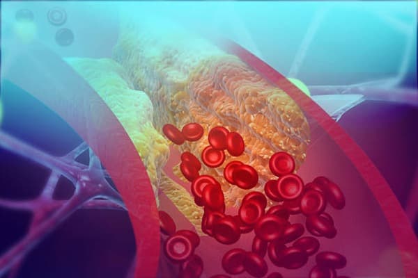 Body fluids and circulation Quiz 3